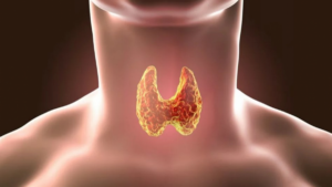 Подробнее о статье Рак щитовидной железы