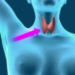 Эндоскопические операции на щитовидной и паращитовидных железах