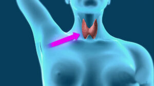 Подробнее о статье Эндоскопические операции на щитовидной и паращитовидных железах